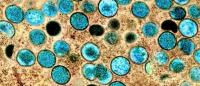 NIAID image of monkeypox viruses as seen under a microscope